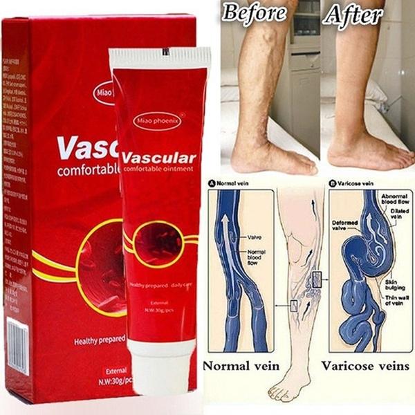 CREMA VASCULAR ANTIVARICOSA